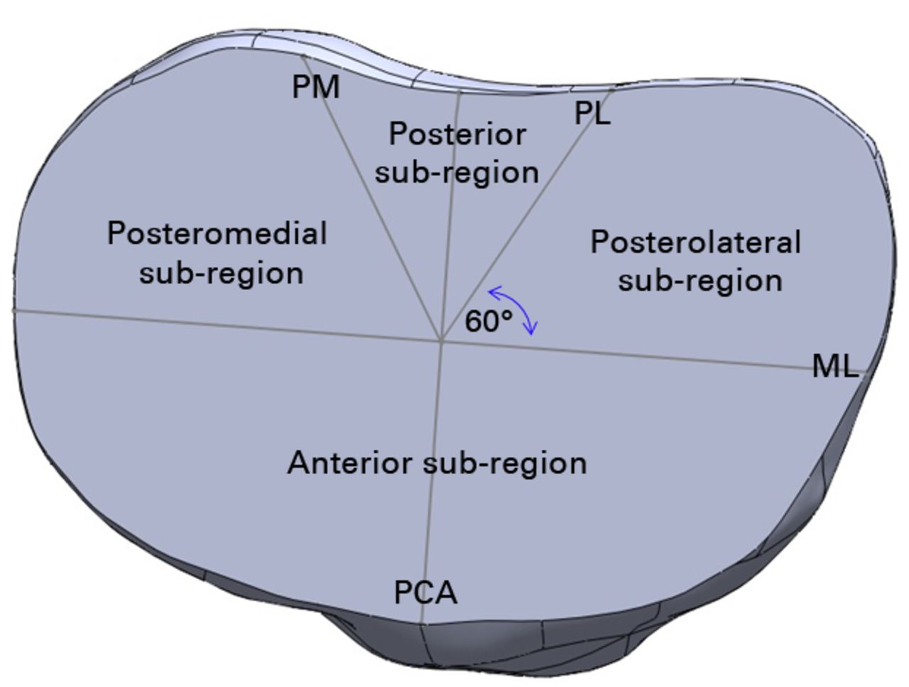 Fig. 3 
            Diagram showing the sub-regions of interest
(PM, posteromedial line; PL, posterolateral line, ML, mediolateral
line; PCA, posterior condylar axis).
          
