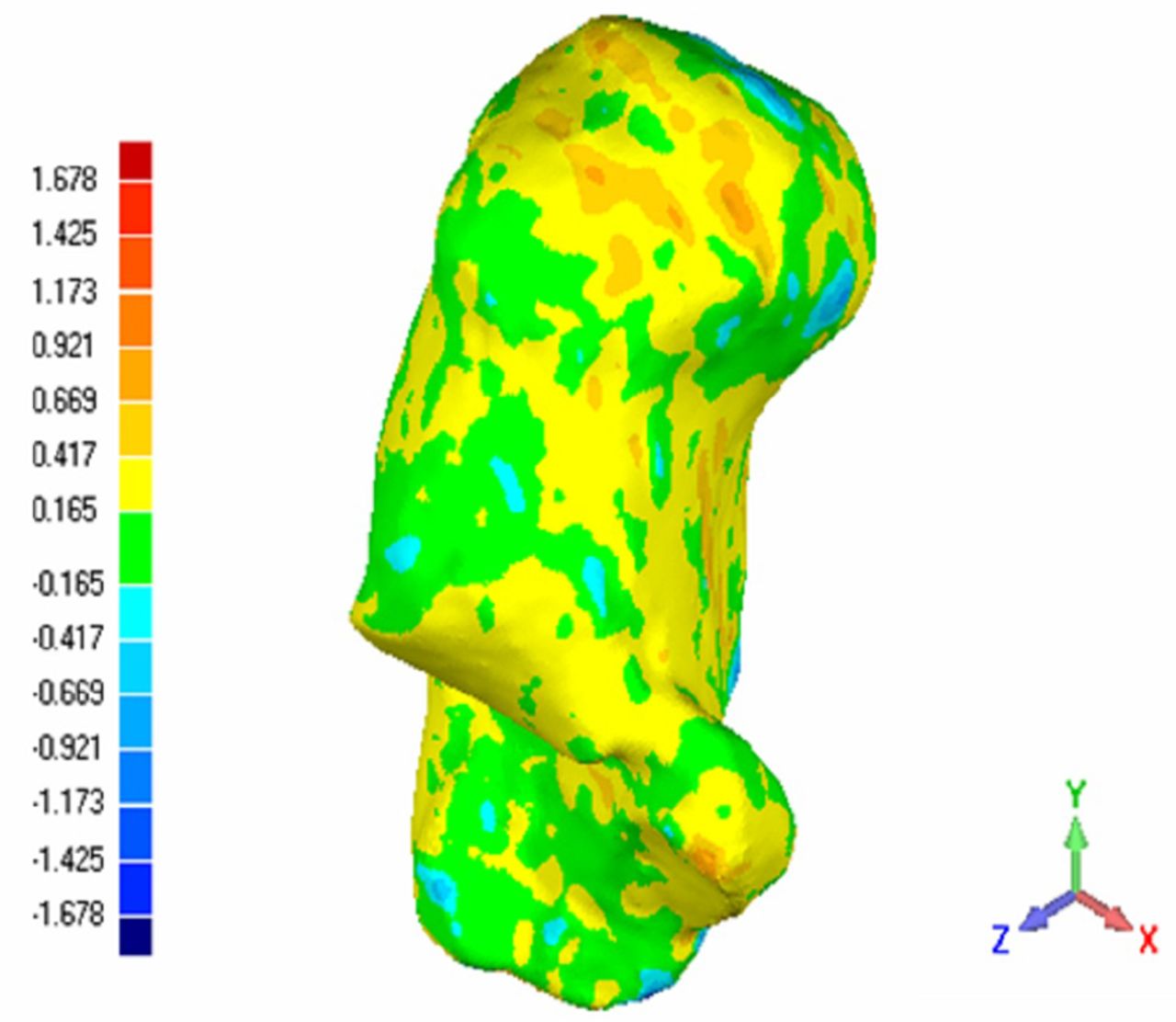 Fig. 7 
            Three-dimensional deviation analysis
of the calcaneus registration rate.
          