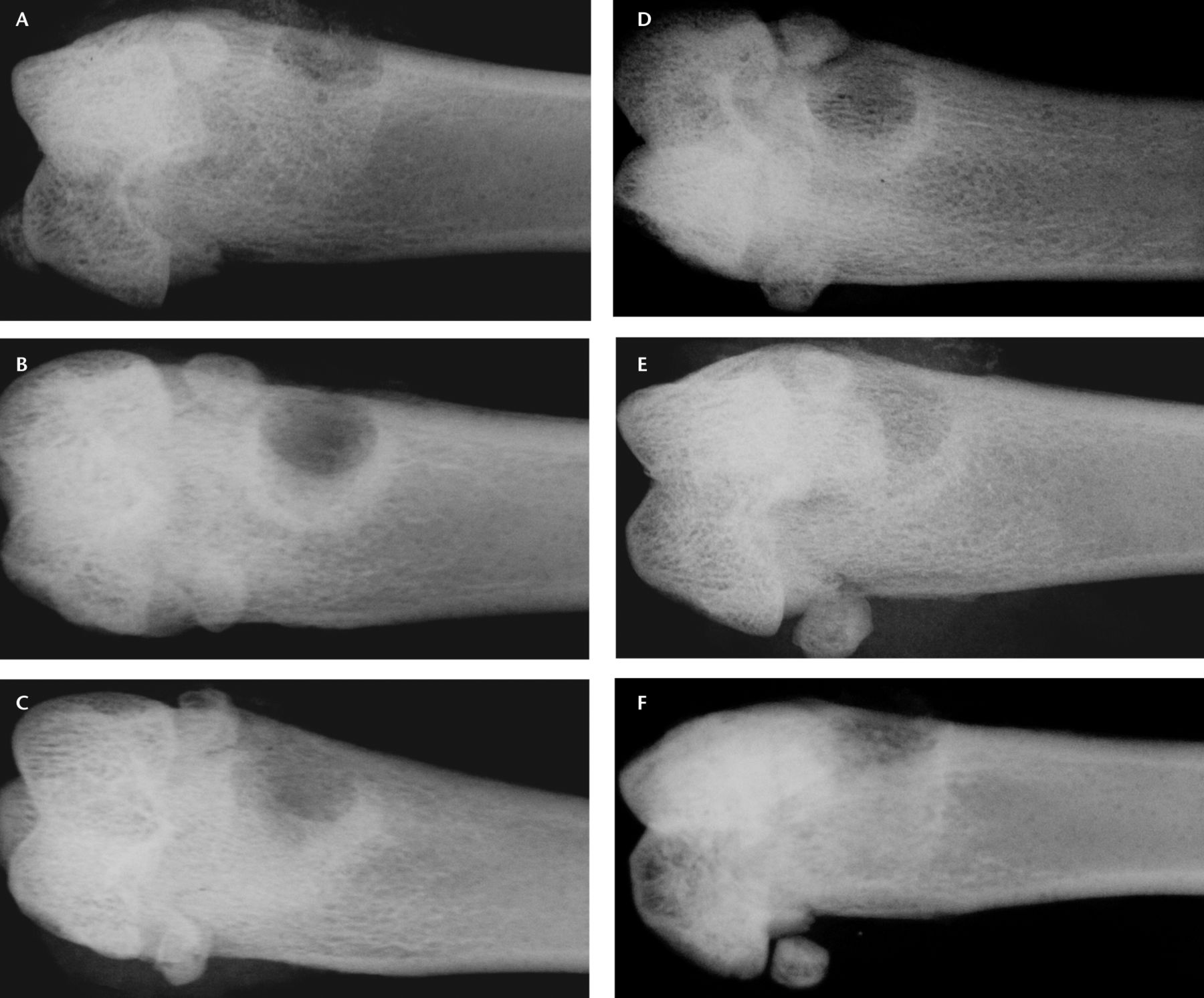 Fig. 2 
            Sample radiographs from each group after
ten days of healing in a) an open defect, b) a polycaprolactone
(PCL)-only defect, c) a CaSO4-only defect, d) a low-dose
A-79175 defect, e) a medium-dose A-79175 defect, and f) a high-dose
A-79175 defect.
          