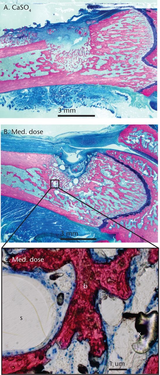 Fig. 3 
            Histological images of femoral defects
at ten days post-operatively in a) the control group (CaSO4-only)
and b) the medium-dose group treated with A-79175, and c) magnified
to show newly formed bone (b), the void left by the polycaprolactone
scaffold (s) and artifactual air bubbles from the embedding process
(x).
          