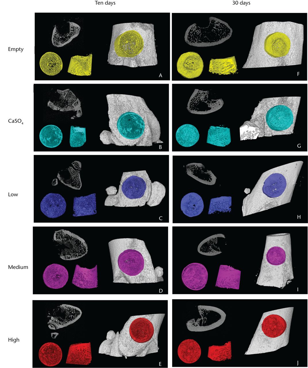 Fig. 4 
            Representative three-dimensional micro-CT
reconstructions of the femoral defect sites, with the ten-day samples
in the left column and the 30-day samples in the right. Within each panel
are (top left) a two-dimensional slice of the defect, (bottom left)
the analysed volume shown from top-down and side views, and (right)
the highlighted defect within the femur.
          