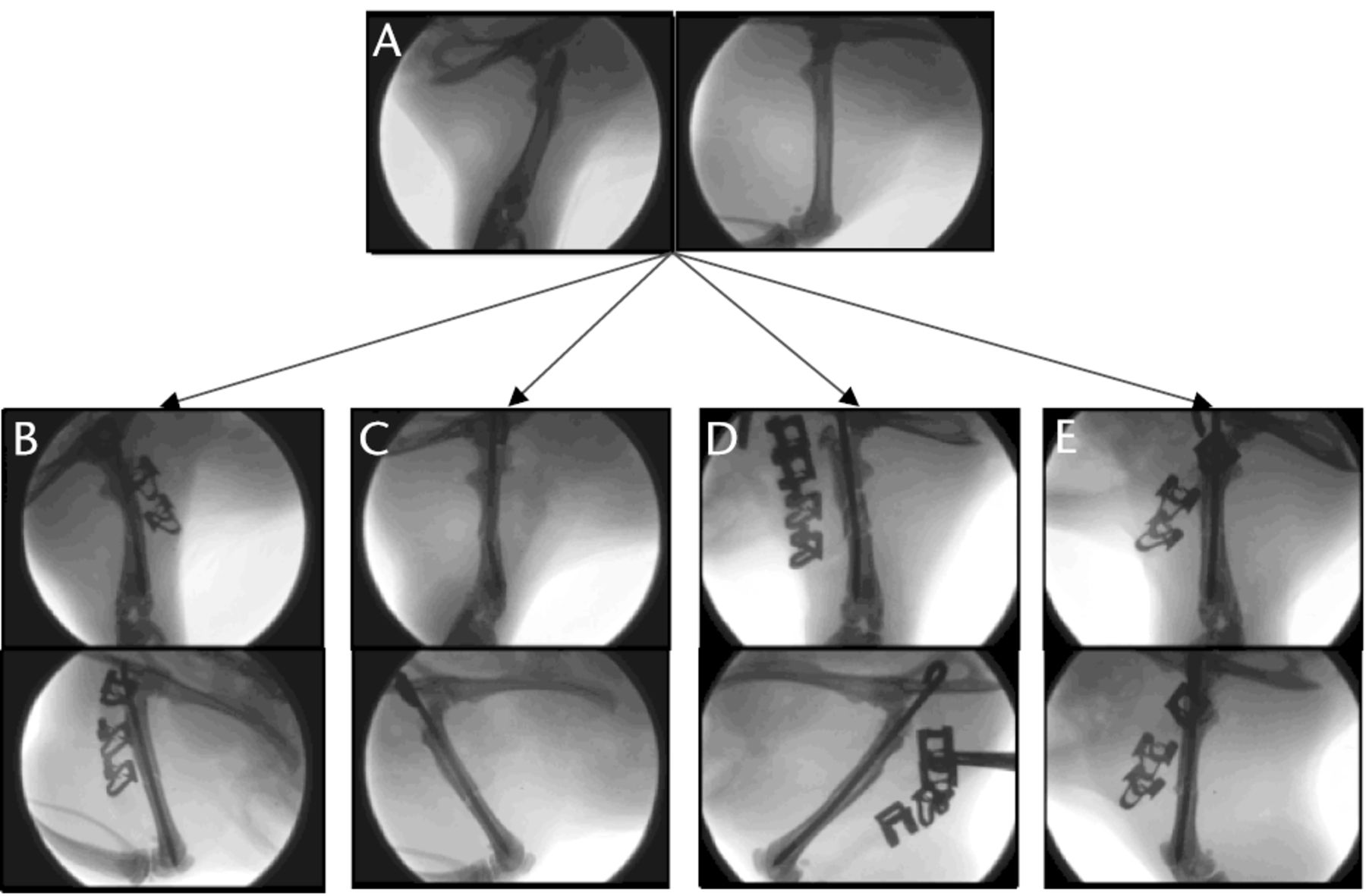 Fig. 3 
          Fluoroscopic images showing the range
of fractures created with a dropping tower: a) normal rat femur,
b) perfect fracture, c) fracture with no bending in the lateral
plane but marked bending in the anteroposterior plane, d) fracture
with slight comminution, and e) fracture with excessive comminution.
        