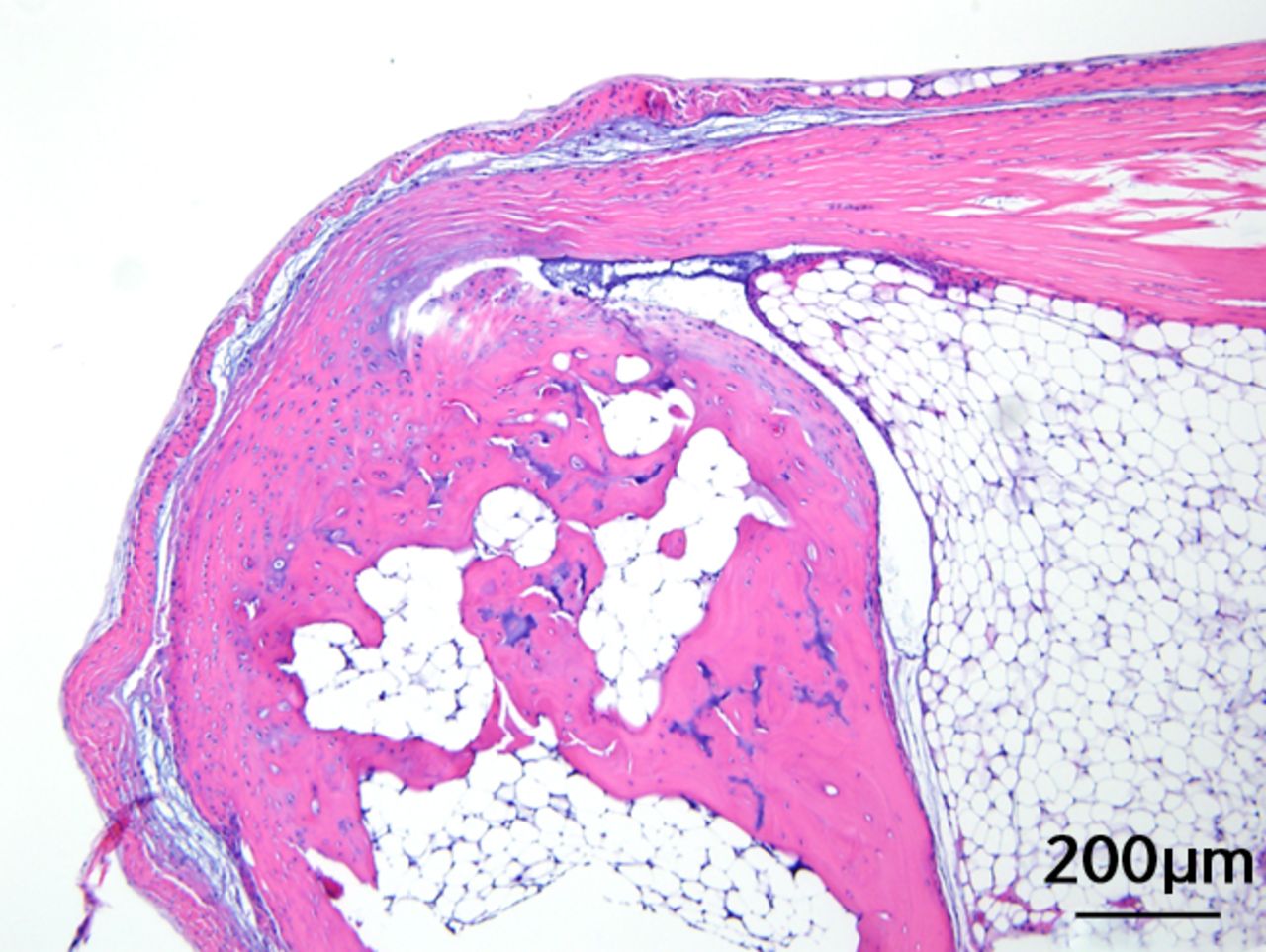 Figs. 3a - 3c 
            
              Figures 3a and 3b – histological
images of the Achilles tendon at insertion in a) a sedentary, control-diet
animal (neither high-fat diet (HFD) nor branched-chain amino acid
(BCAA)), and b) in an exercise (Ex), HFD and BCAA treated mouse
(both haematoxylin &
 eosin, bar 200 µm). Figure 3c – bar chart
showing the mean quadriceps muscle fibre diameter measured following
tissue collection. Groups not sharing a letter (‘a’ or ‘b’) are
significantly different, based on a significant main effect for
exercise and no other significant main effects or interactions.
Error bars indicate standard deviation.
          