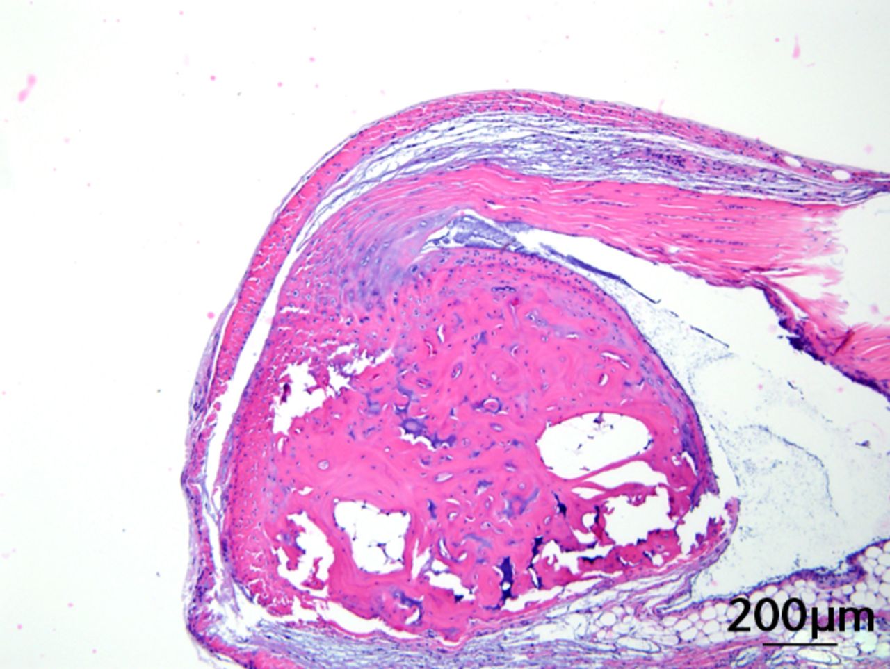 Figs. 3a - 3c 
            
              Figures 3a and 3b – histological
images of the Achilles tendon at insertion in a) a sedentary, control-diet
animal (neither high-fat diet (HFD) nor branched-chain amino acid
(BCAA)), and b) in an exercise (Ex), HFD and BCAA treated mouse
(both haematoxylin &
 eosin, bar 200 µm). Figure 3c – bar chart
showing the mean quadriceps muscle fibre diameter measured following
tissue collection. Groups not sharing a letter (‘a’ or ‘b’) are
significantly different, based on a significant main effect for
exercise and no other significant main effects or interactions.
Error bars indicate standard deviation.
          