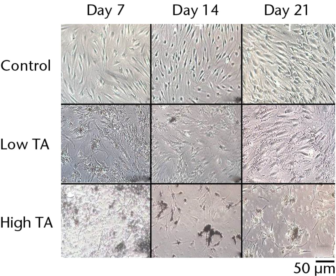 Fig. 2 
            Cell morphology showing that exposure
to triamcinolone acetonide (TA) for seven days yielded flattened
and polygonal cells. However, cells in the low TA group had a similar
appearance to the control cells at day 21. In the high TA group,
there was no recovery of appearance after 21 days.
          