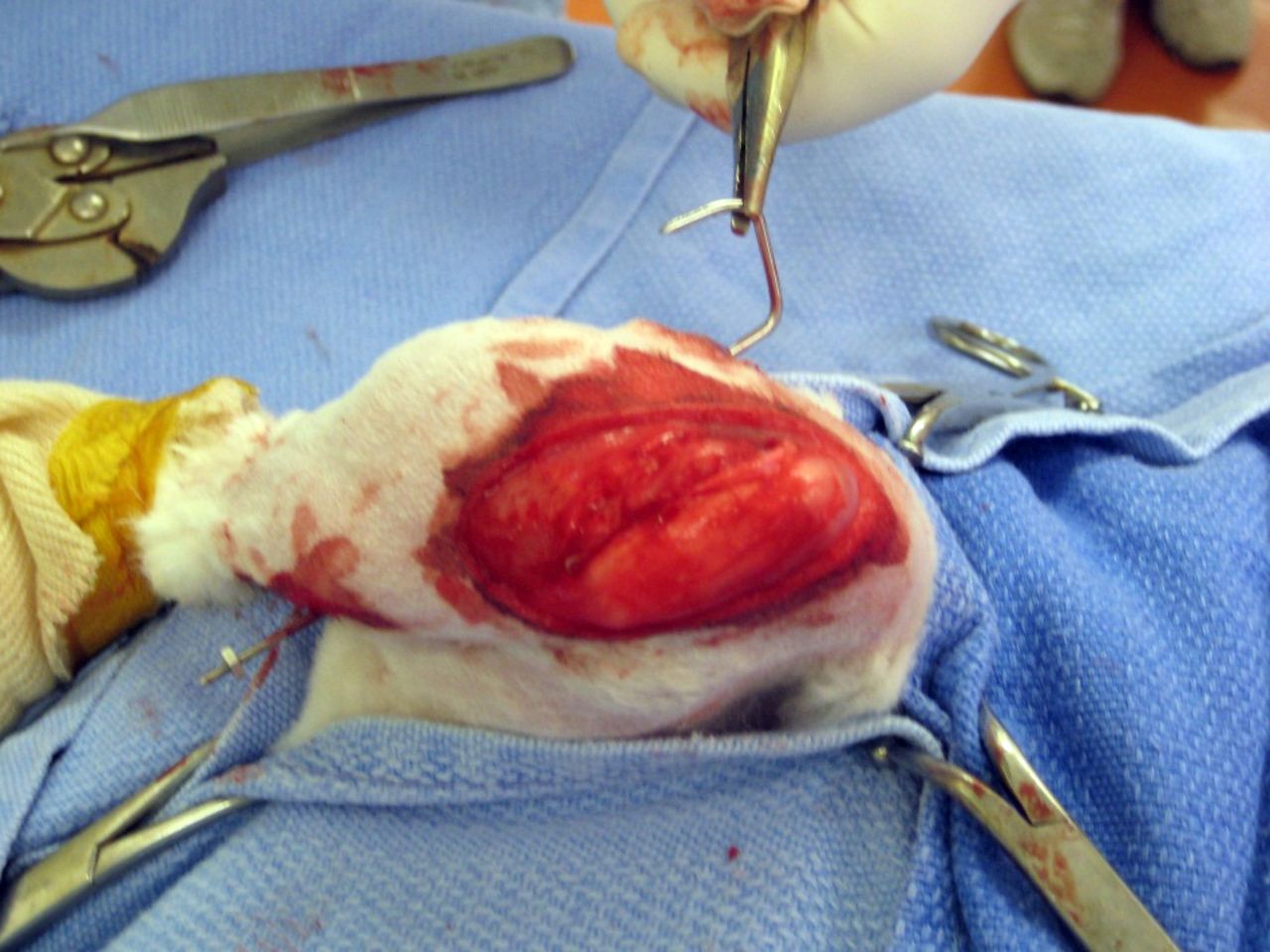 Fig. 1 
          Intra-operative photograph of
right knee immobilisation and formation of contracture with K-wire.
        