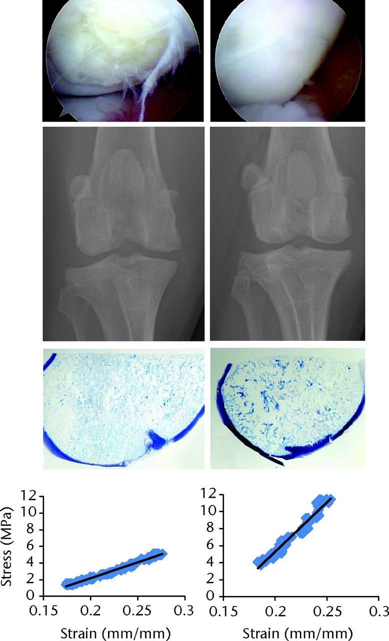 Fig. 1 
          Corresponding arthroscopic (top), radiological,
histologic (toluidine blue stain) and biomechanical (Young’s Modulus)
assessments of two different focal (10 mm) osteochondral defect
treatments in the femoral condyles of dogs at six months after implantation.
The defect on the left was treated with an osteochondral allograft
that was preserved such that chondrocyte viability was <
 70%
at the time of implantation. The defect on the right was treated
with an osteochondral allograft that was preserved such that chondrocyte
viability was >
 90% at the time of implantation.
        