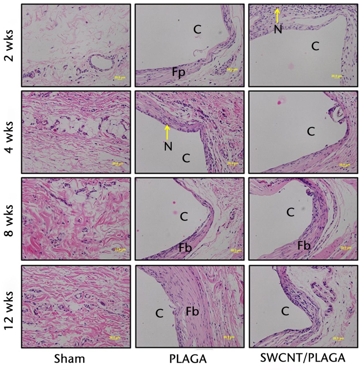 Fig. 7 
            Micrograph of subcutaneous skin tissues
of rats implanted with Sham, poly (lactic-co-glycolic acid) (PLAGA)
and single-walled carbon nanotubes (SWCNT)/PLAGA at two, four, eight
and 12 weeks post-implantation stained with haematoxylin and eosin (×20
magnification). C, composite (PLAGA or SWCNT/PLAGA) implant site;
M, muscular tissue; N, polymorphonuclear neutrophils; Fp, fibroplasia;
Fb, fibrosis.
          