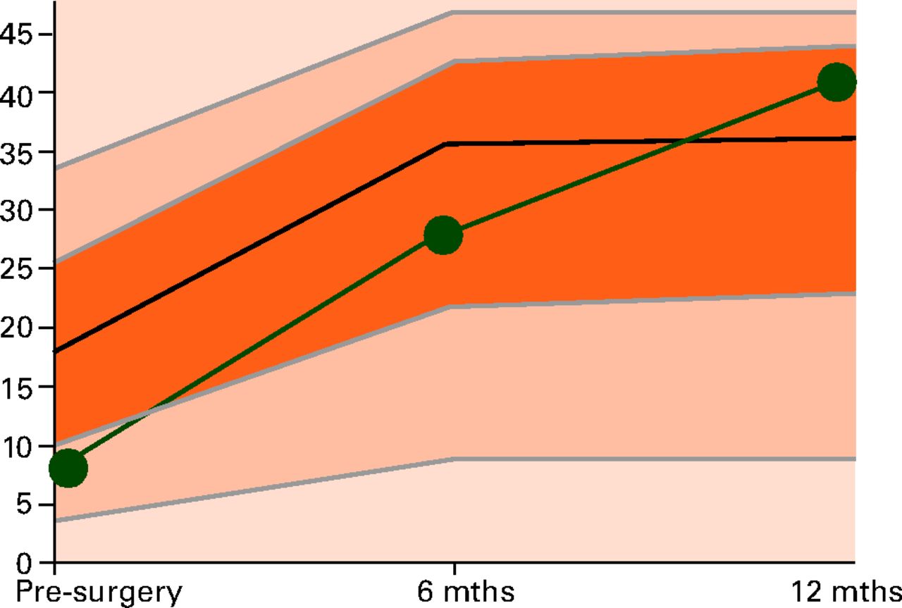 Fig. 3 
            Example line chart for an individual
patient. Using computer interfaces, an appropriate age and gender
matched plot can be produced for the individual hip or knee arthroplasty patient.
The above figure represents the specific reference ranges for 70-
to 80-year-old females undergoing total hip arthroplasty. The green
line charts the progress of a 72-year-old woman, highlighting that
they were amongst the most severely disabled of patients prior to
surgery, however had achieved within a standard deviation of the
average outcome of their age- and gender-matched peer group by six
months post-operatively, and actually reported better than average
outcome at 12 months.
          
