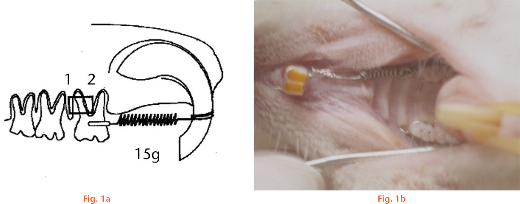  
            Design of the experimental tooth movement model: (a) a diagram of the orthodontic appliance design (1, tension side; 2, compression side); and (b) the upper left first molar was moved mesially by a closed coil spring with a force of 15 g.
          