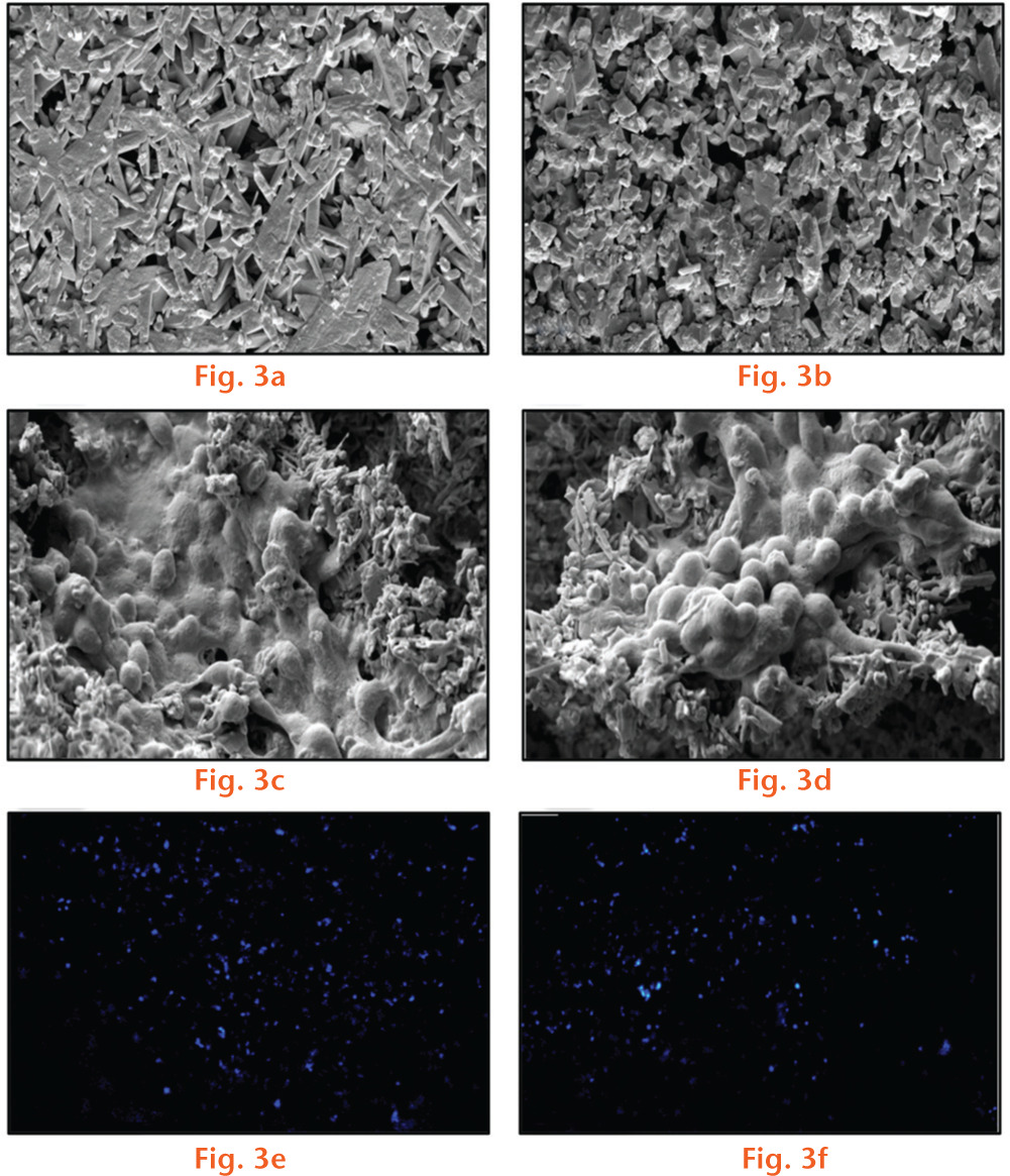 
            Scanning electron microscopy (SEM) and cell material interactions. SEM images in panel (a) and (b) represent hydroxyapatite-calcium sulphate (HA-CS) and HA-CS-gentamicin (G), respectively, at high magnification (3000×). SEM and microscopic analysis of C2C12 muscle myoblasts proliferating on HA-CS (c, e) and HA-CS-G (d, f) three days post-seeding.
          