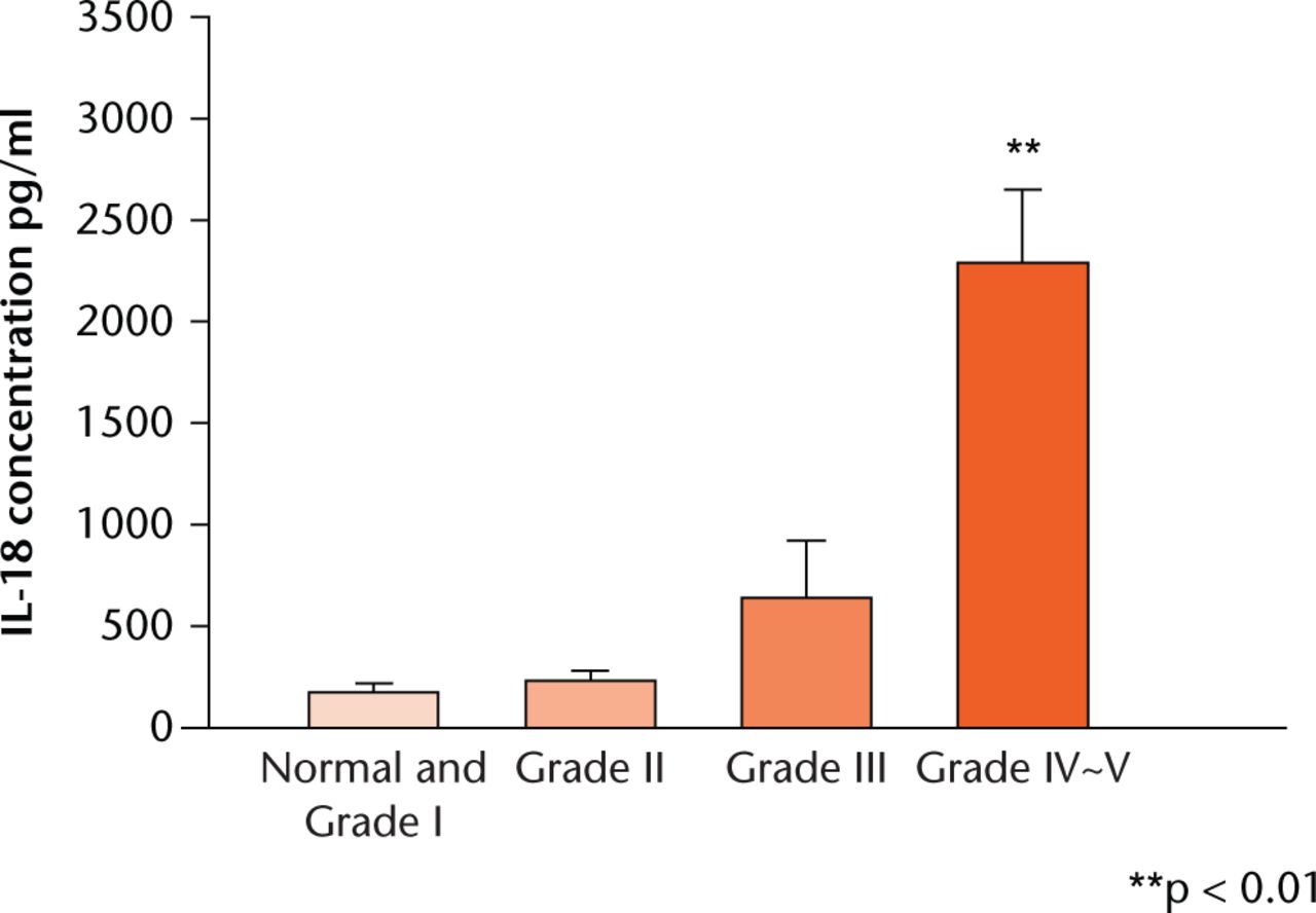 Fig. 1 
            Graph showing whole blood from healthy individuals and disc degeneration patients before surgery was collected and analysed by enzyme-linked immunosorbent assay to determine the Interleuklin(IL)-18 level. Each value represents the mean and standard error of the mean of at least three independent experiments. ** p < 0.01 vs normal group.
          