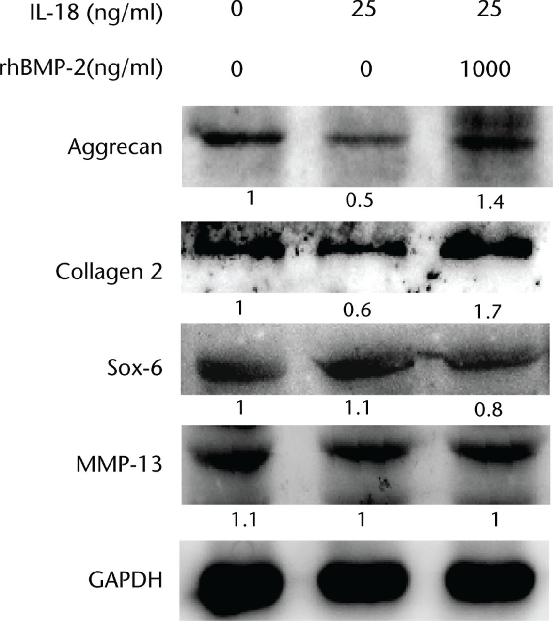 Fig. 4 
            Western blot analysis of protein expression of aggrecan, type II collagen, MMP13, and SOX6 in response to combined treatment with interleukin (IL)-18 and recombinant human (rh)BMP-2. Cells were harvested at 24 hours and immunoblotted with specific antibodies. The relative densities (RD) of proteins were quantified and plotted against the signal obtained from the control after normalisation to Glyceraldehyde 3-phosphate dehydrogenase (GAPDH).
          