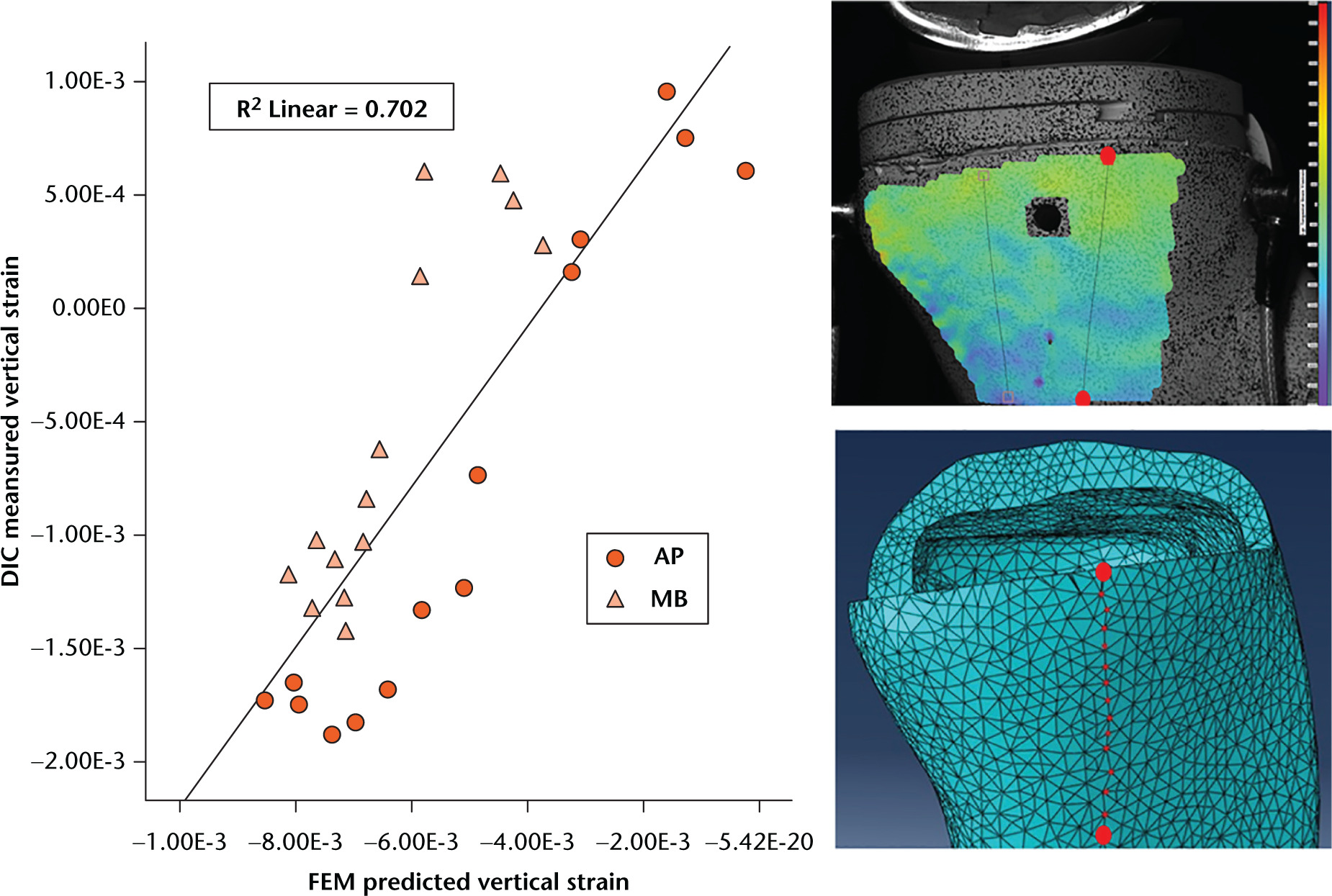 Fig. 3 
            Scatter graphs showing digital image correlation (DIC) measured cortical bone vertical strain along an anteromedial line for 8 mm all-polyethylene (AP) and metal-backed (MB) implants (inset) and predicted finite element model (FEM) vertical strain data at nodes along the same line (inset).
          