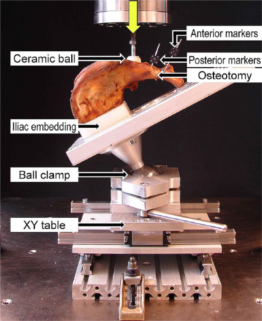 Fig. 2 
            Photograph showing test setup with a specimen mounted for biomechanical testing with markers attached on each fragment side for optical movement tracking. Vertical arrow denotes loading direction.
          