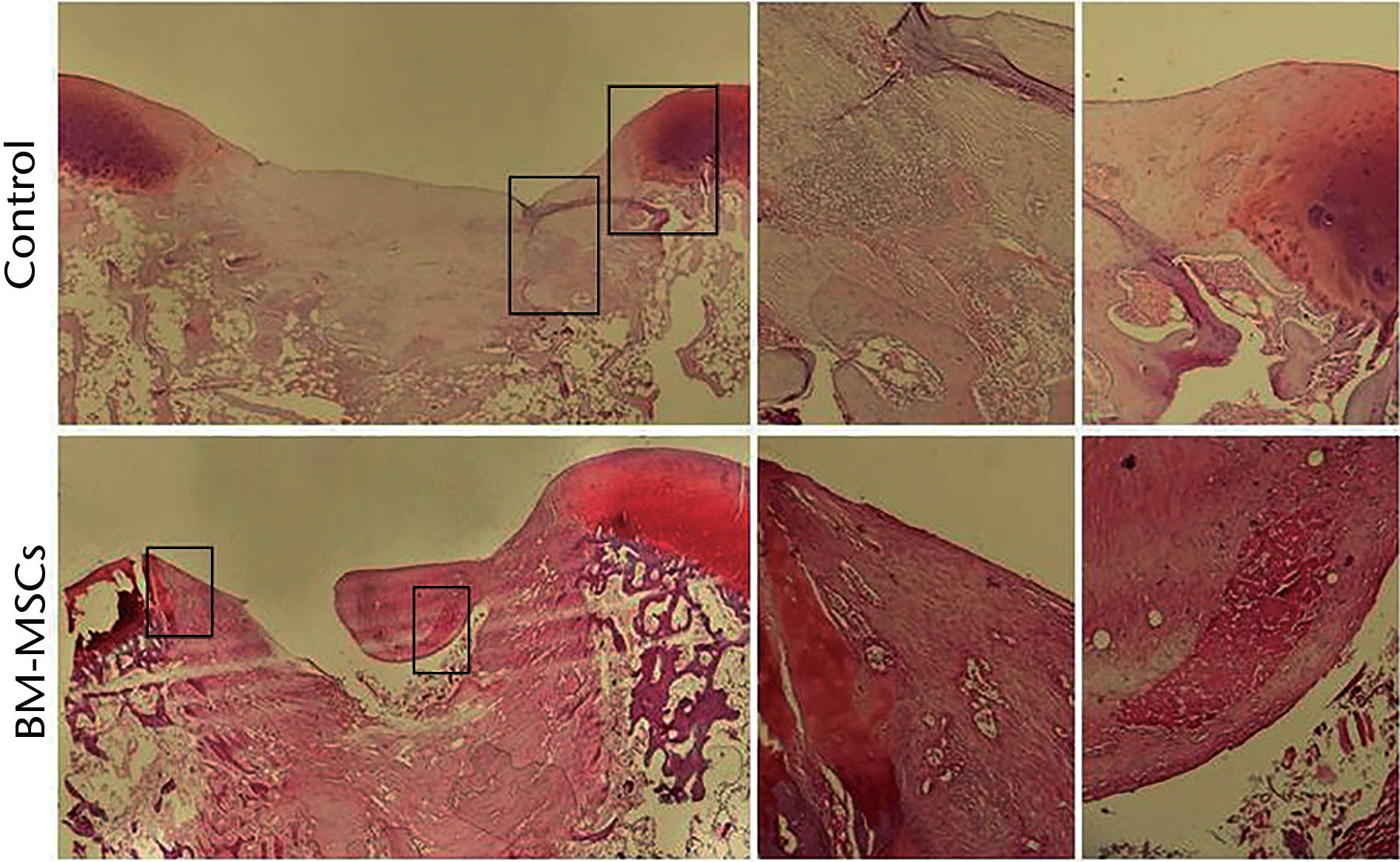 Fig. 4 
            Histological appearance of defects in the condylar region at four weeks after surgery. Control as well as stem cell treated (bone-marrow derived mesenchymal stem cell) defects are represented. Magnified views of the boxes are presented in the middle and right side. SafraninO staining; original magnification 40x (left side) and 100x (middle and right side).
          