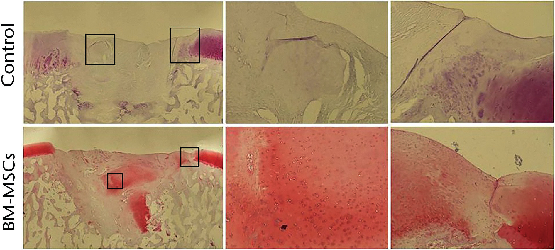 Fig. 5 
            Histological appearance of defects in the condylar region at 16 weeks after surgery. Control as well as stem cell treated (bone-marrow derived mesenchymal stem cell) defects are represented. Magnified views of the boxes are presented in the middle and right side. Safranin O staining; original magnification 40x (left side) and 100x (middle and right side).
          