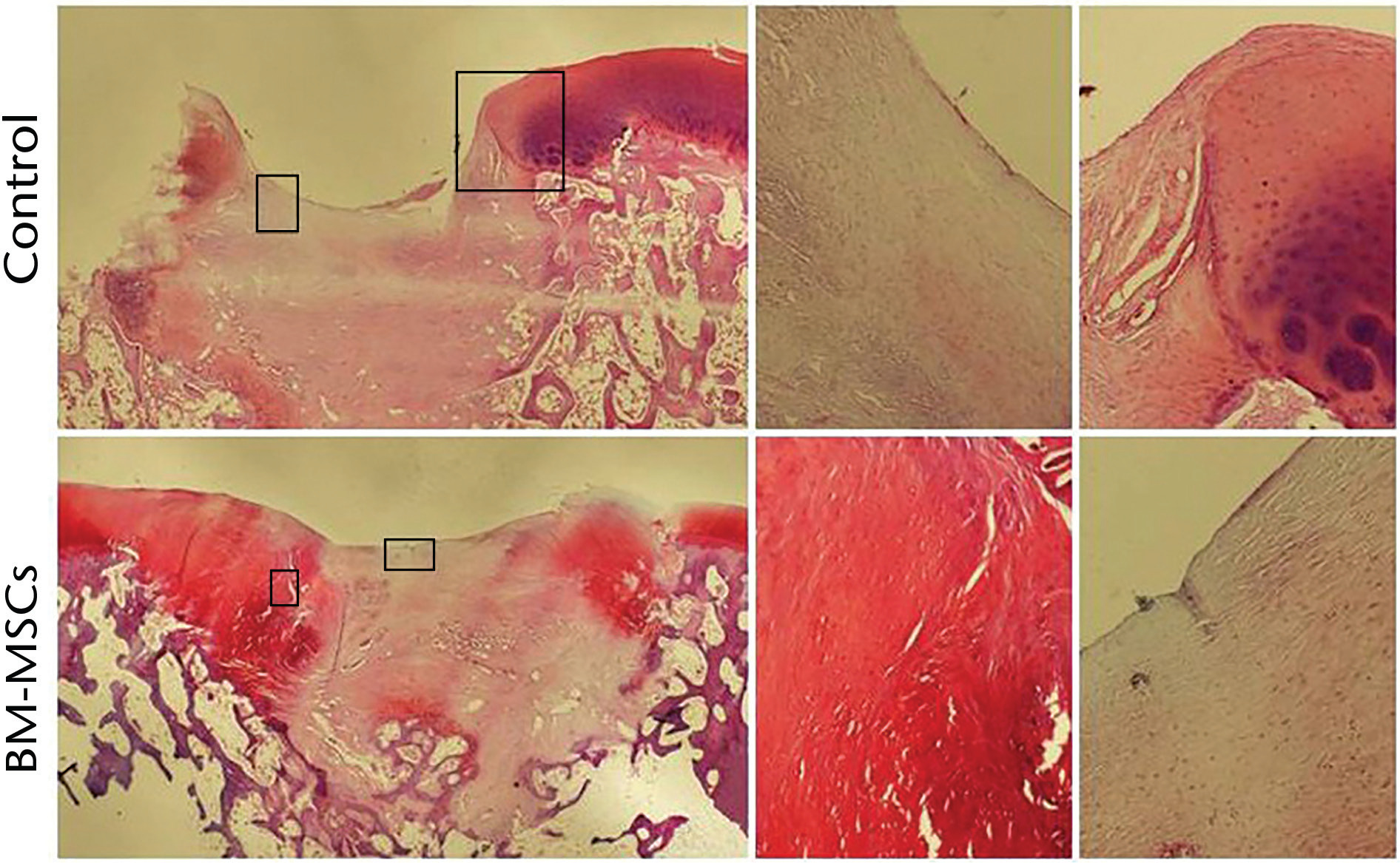 Fig. 6 
            Histological appearance of defects in condylar region at 24 weeks after surgery. Control as well as stem cell treated (bone-marrow derived mesenchymal stem cell) defects are represented. Magnified views of the boxes are presented in the middle and right side. Safranin O staining; original magnification 40x (left side) and 100x (middle and right side).
          