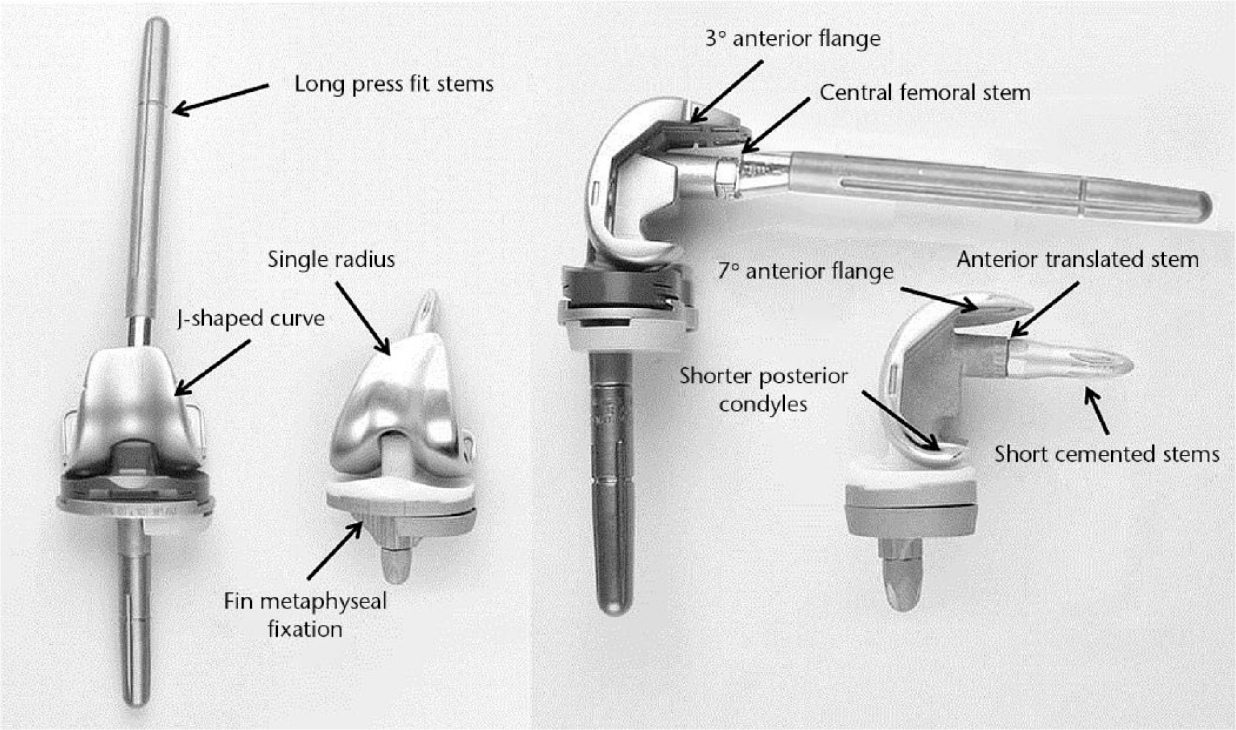 Fig. 1 
            Anterior and lateral views of the Kinemax TS (to the left) and Triathlon TS (to the right) revision TS TKA systems.
          