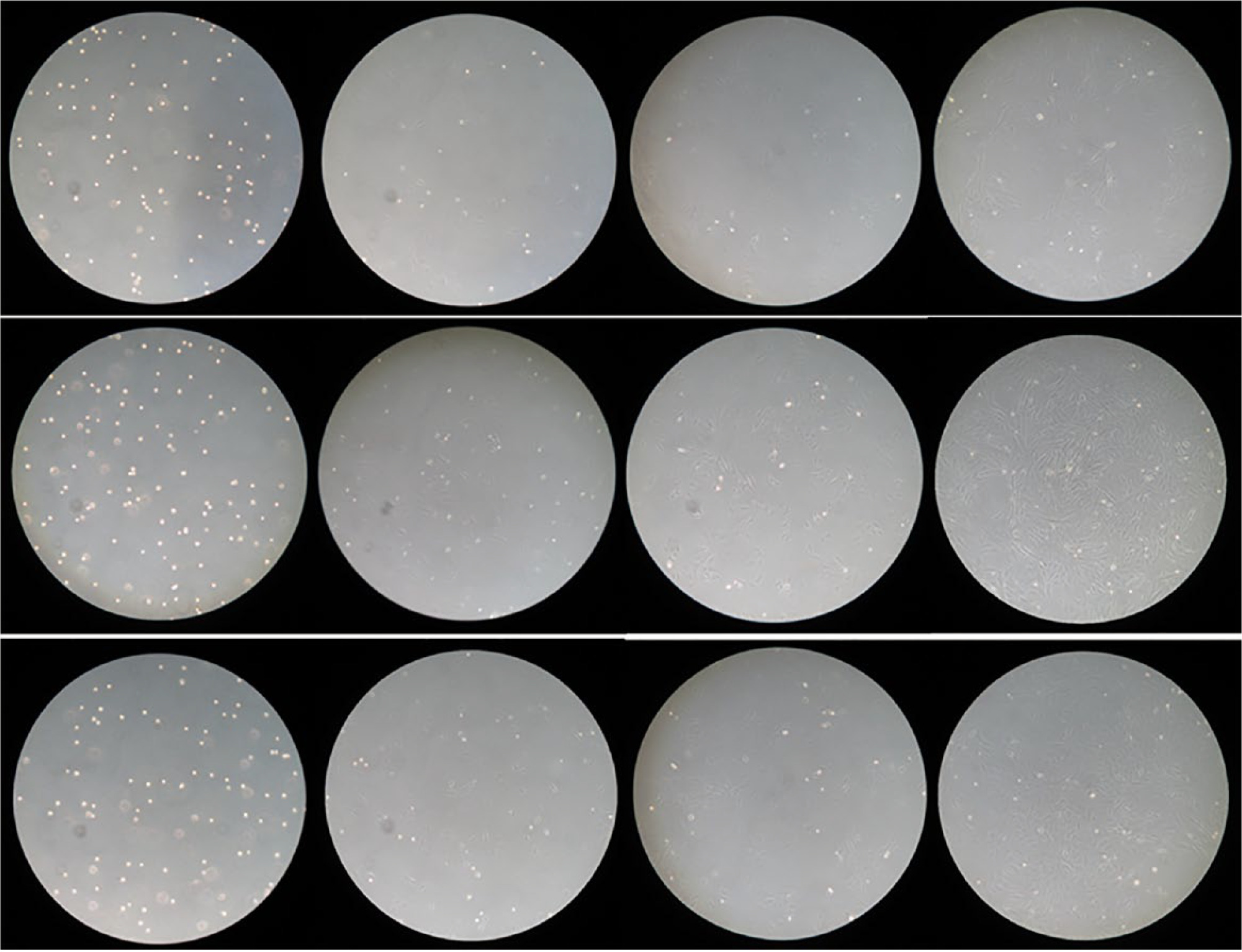 Fig 1 
            Microscopic findings (×100). Top row: control group; middle row: low-dose group; bottom row: high-dose group. From left to right are microscopic findings from the start of the culture and after 1, 3, and 5 days.
          