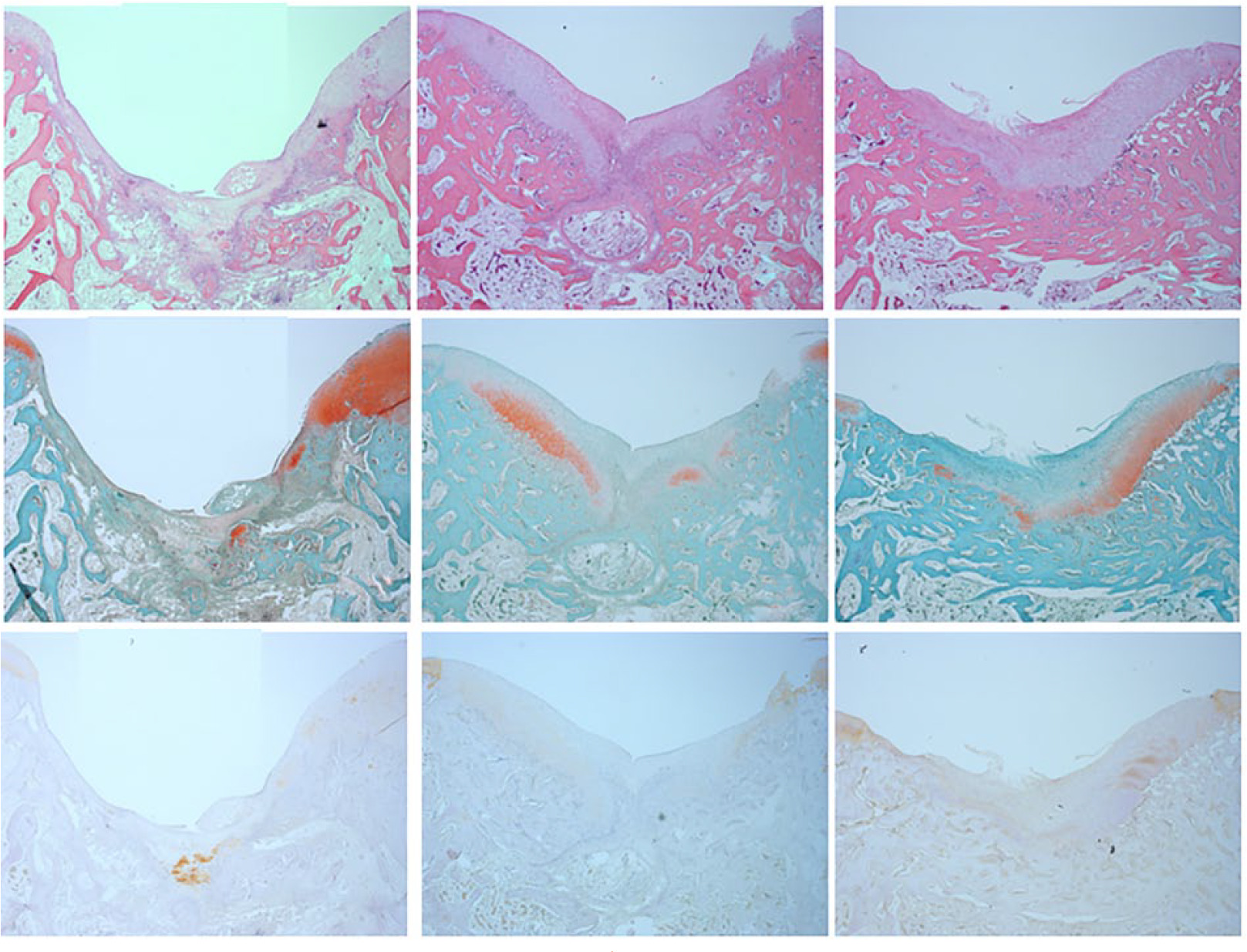 Fig 5 
            Microscopic findings at 4 weeks (×100). Top row: haematoxin and eosin staining; middle row: safranin O staining; bottom row: collagen type II staining. From left to right are microscopic findings from the control group, the low-dose group, and the high-dose group.
          