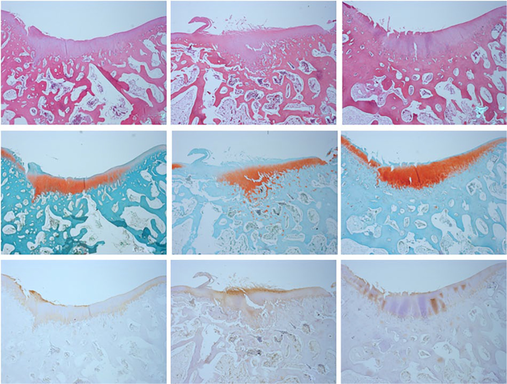 Fig 7 
            Microscopic findings at 12 weeks (×100). Top row: H&E staining; middle row: safranin O staining; bottom row: collagen type II staining. From left are microscopic findings from the control group, the low-dose group, and the high-dose group.
          