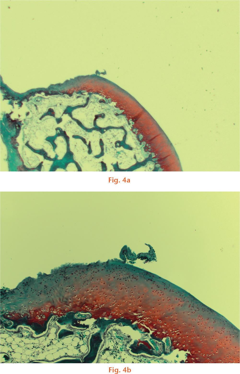  
          Cartilage sample from the operative knee of an animal undergoing Mayo contracture model surgery. These illustrations demonstrate changes due to artefact.
        