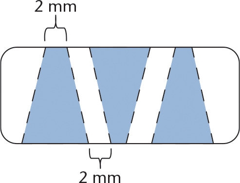 Fig. 1 
            Diagram of newly designed, lateral fan-shaped slits. The alternating singled-sided, fan-shaped slits (shaded area) were made on the tendon at 2-mm intervals over a 2-cm length.
          