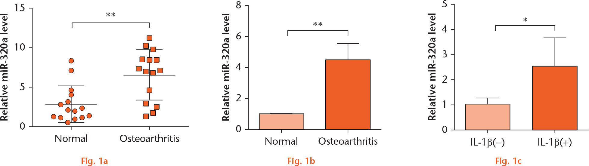  
            miR-320a was elevated in OA. (a) Expression of miR-320a in normal (n = 15) and OA cartilage cells (n = 15) was measured by RT-PCR. (b) The level of miR-320a in normal and OA chondrocytes was measured by RT-PCR. (c) C28/I2 cells were stimulated with IL-1β for 24 hours, and then the level of miR-320a was determined by RT-PCR. *, p < 0.05; **, p < 0.01. Statistical analysis was performed using two-tailed paired t-test.
          
