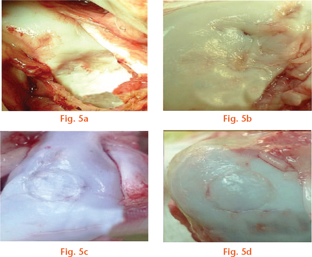  
            Macroscopic view of articular cartilage defects in control, BA, CBA, and auto groups at six months post-implantation.
          