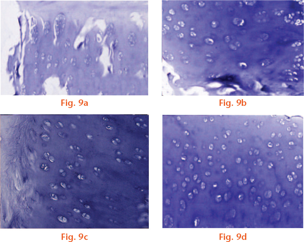  
            At 24 weeks, the repaired sites in the c) CBA and d) auto groups displayed uniform, positive staining for cartilaginous ECM, comparable with that of normal cartilage. The results of the 24-week TB staining showed that the engineered cartilage in the CBA group c) was better than that in the BA group b), while the engineered cartilage in the control group a) was the poorest among the groups, TB×200.
          