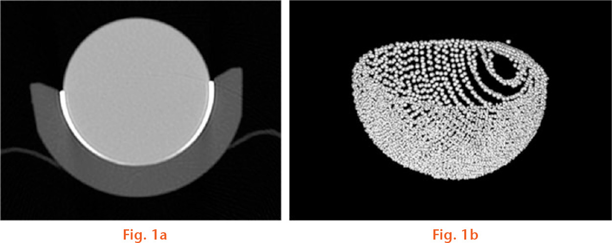  
          Imaging of contrast medium as a fingerprint of wear in the CT scan (a), segmentation and calculation of the volume (b).
        