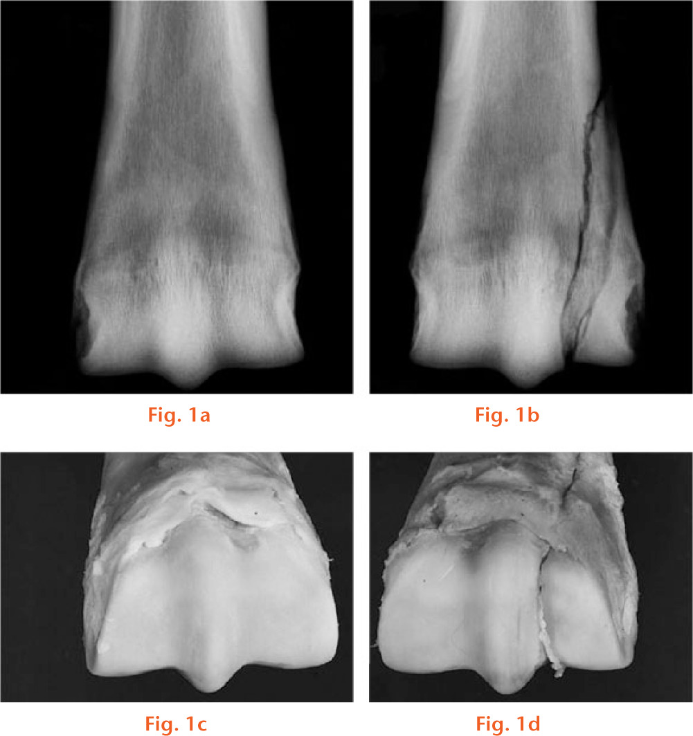  
            Dorsopalmar (anterior/posterior) radiographs of a) intact third metacarpal bone (Mc-III) and b) fractured bone of same horse. Photograph of articular surfaces of c) intact bone and d) fractured Mc-III. Left medial and right lateral side.
          