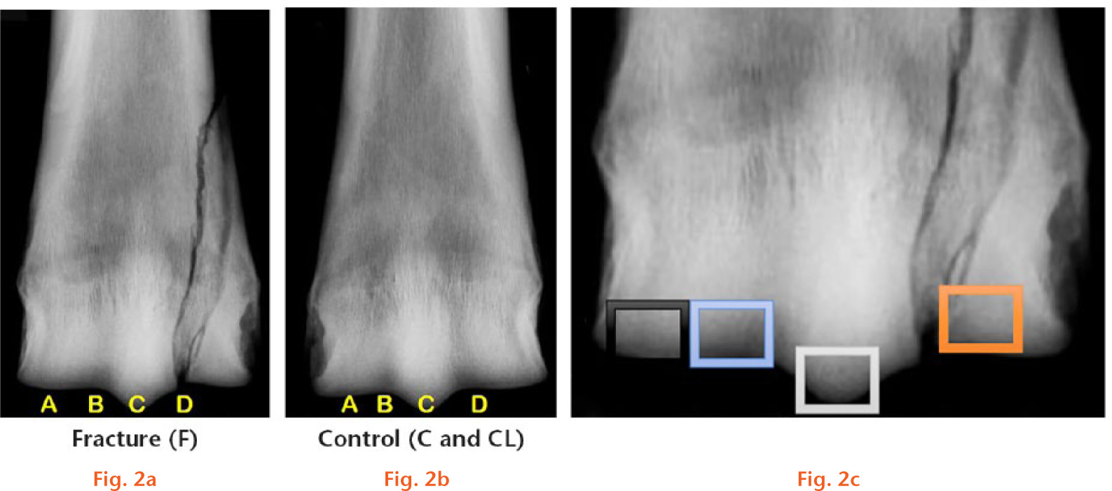  
            Dorsopalmar radiographs of a) fractured third metacarpal bone and b) control and contralateral bone. The different regions used in the analysis of staining are shown. A, medial condyle; B, medial condylar groove; C, sagittal ridge; D, lateral condylar fracture site. In c), the sampling site regions are shown, corresponding to A to D in a) and b).
          