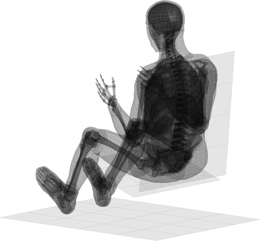Fig. 1 
            Image of the validated FE model, with a rigid seat and floor shown using a semi-transparent filter.
          
