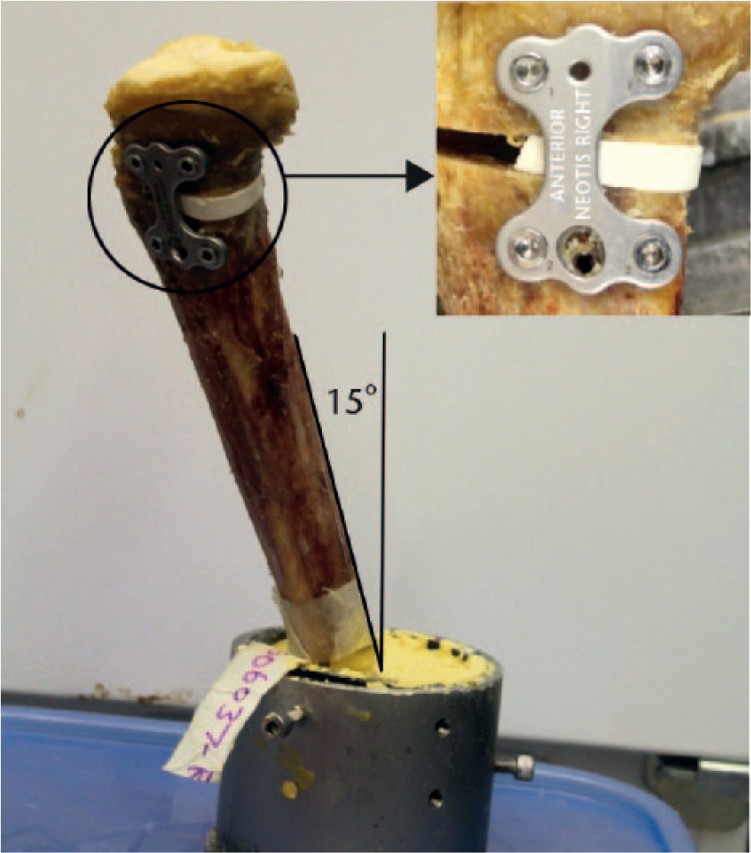 Fig. 2 
            The tibia potted at 15° with respect to a composite femur (not shown) and with the osteotomy fixation plate shown on the medial aspect (inset). It should be noted that the white insert was only used to establish the width of the opening and was not left in for testing.
          