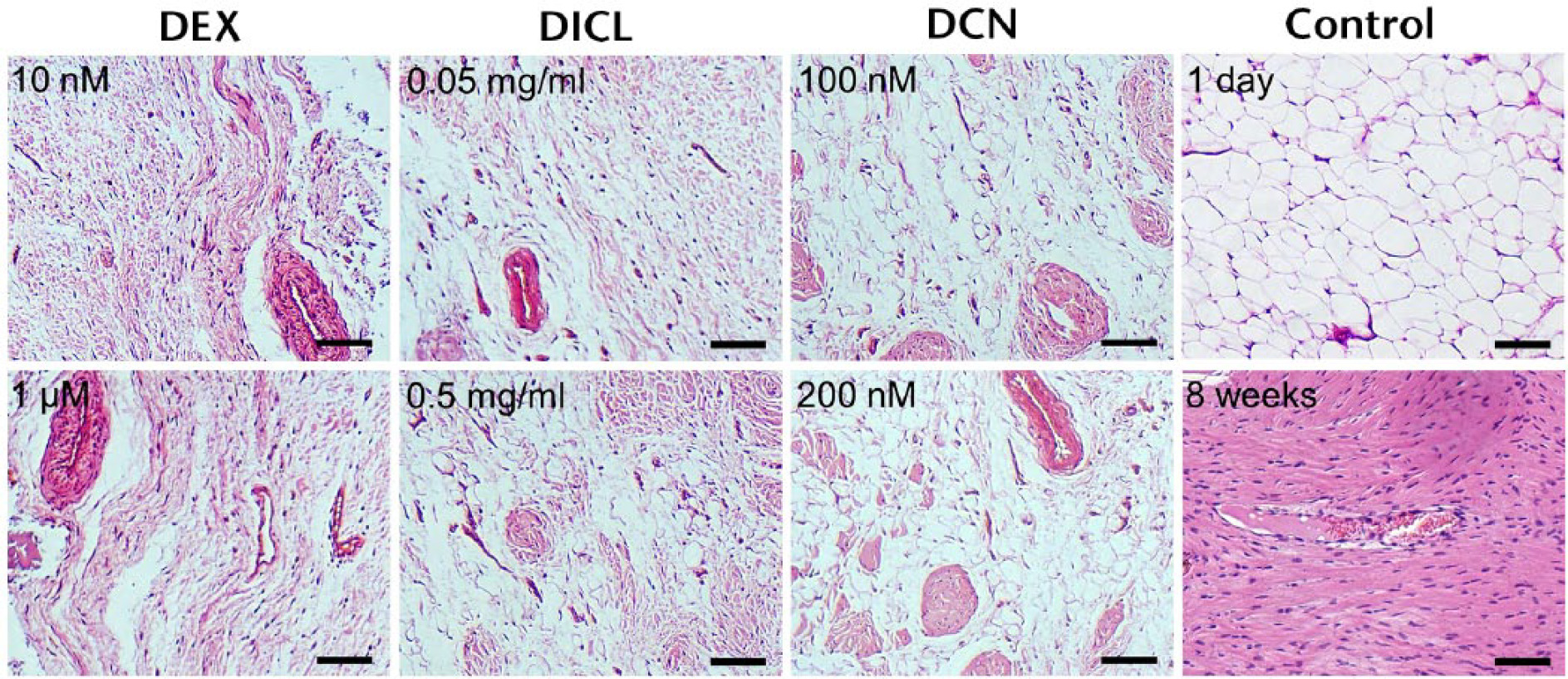 Fig. 6 
            Histological analysis of infrapatellar fat pad of the joints in different groups. The specimens in control group harvested after one day and eight weeks served as negative and positive controls, respectively (stain, hematoxylin, and eosin). DEX, dexamethasone; DICL, diclofenac; DCN, decorin. Scale bar = 200 μM.
          