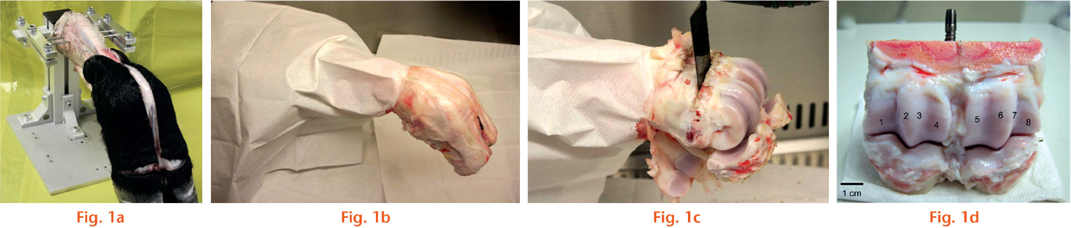  
            Photographs showing preparation of the bovine metatarsophalangeal joint and the cartilage sampling sites: a) the bovine foot was suspended in the frame by inserting two metal pins at the proximal metatarsus. The incision was from the midline of the metatarsus down to the proximal interphalangeal joint with a transverse circumferential cut so that the hide and hoof could be removed; b) the skinned foot was wrapped with sterilized paper to establish a sterile safety zone; c) after removal of the surrounding soft tissues, the metatarsophalangeal joint was then exposed and cut off at approximately 1 cm above and below the cartilage margin; d) for the dynamic model, a specially made peg was inserted into the top of the transected metatarsal bone of the joint. Cartilage samples were taken from eight articular facets in the metatarsal part of the joint. The facets numbered 1, 4, 5 and 8 were flatter and larger than the facets numbered 2, 3, 6 and 7, which were located beside the articular ridges. In a typical experiment, facets 1 and 8 each provided five sampling sites, and the other six facets offered six sampling sites each.
          