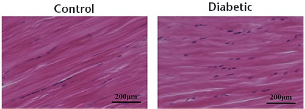 Fig 5 
            Achilles tendon histology. Haematoxylin and eosin staining of control and diabetic Achilles tendons harvested at six weeks following streptozotocin treatment. No obvious pathological difference between control and diabetic tendons was observed.
          