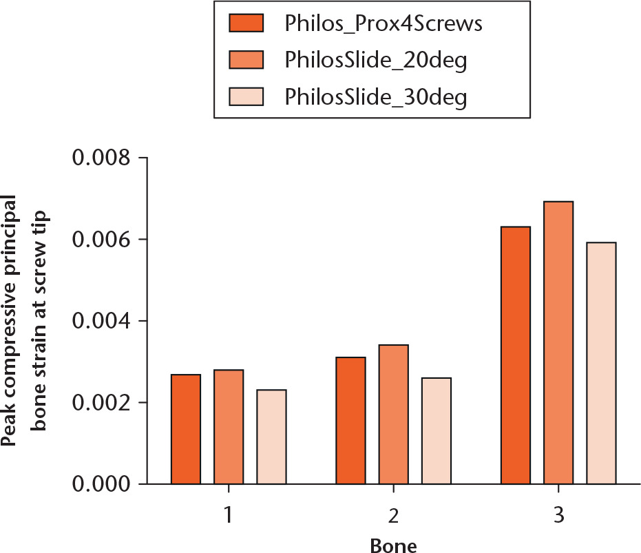Fig. 2 
          Graph showing peak principal compressive bone strains at the tip of the four proximal screws for the standard screw angles of the PHILOS plate (Philos_Prox4Screws) as well as for 20° and 30° angles of the gliding plate (PhilosSlide_20deg and PhilosSlide_30deg, respectively). The 30° screw angle configuration proved to be the most advantageous.
        