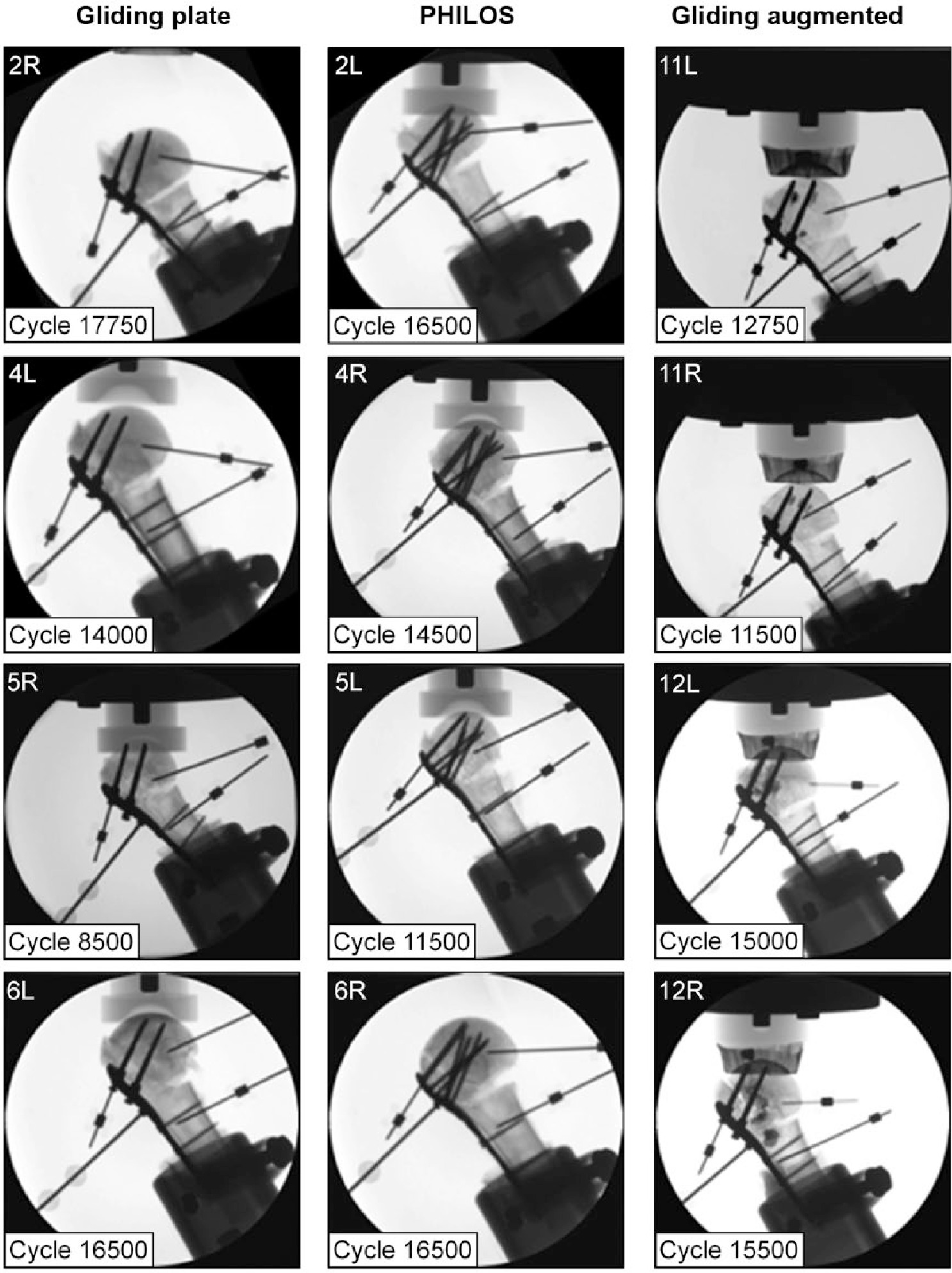 Fig. 6 
          Examples of radiographs of 12 humeri from the three groups with radiologically identified cut-out of the most proximal screw and respective number of cycles to cut-out.
        