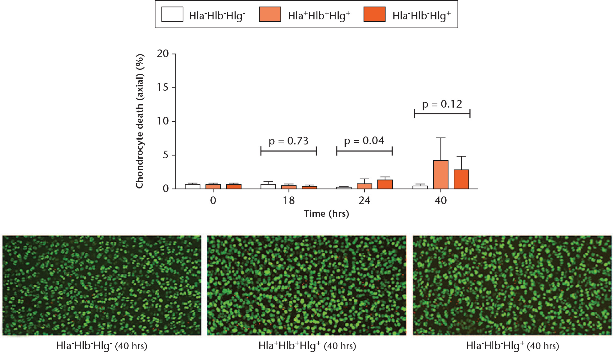 Fig. 3 
            Graph showing that beta-haemolysin (Hlb) and gamma-haemolysin (Hlg) had a negligible effect on in situ chondrocyte viability. Osteochondral explants cultured in the presence of the Hla-Hlb-Hlg-, Hla-Hlb+Hlg+, and Hla-Hlb-Hlg+ strains exhibited minimal chondrocyte death at each timepoint (N = 4 (n = 8); p-values are shown from one-way analysis of variance; *p < 0.05 vs Hla-Hlb-Hlg- strain by post hoc Dunnett’s test). The confocal laser-scanning microscopy images show examples of the chondrocyte death induced by each strain at 40 hours.
          