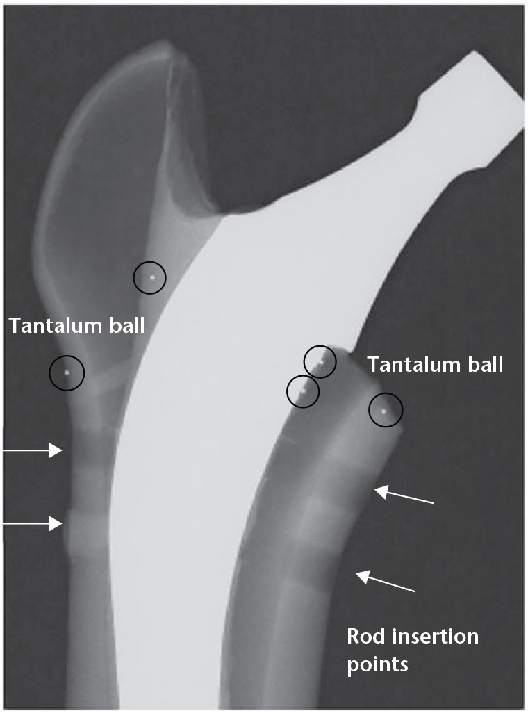 Fig. 2 
            A radiograph taken after fixing the stem with cement. Tantalum ball fitted to the tip of the tube of indwelling needle was inserted in all areas of proximal femur; medial, lateral, anterior and posterior side before cement hardening, push out with needle, and placed in cement. Four balls were also embedded in the outer circumference of the composite femurs 1 cm proximal to the lesser trochanter. These balls were used as markers for micro computed tomography imaging and cement motion analysis. White arrows indicate the holes for tube.
          