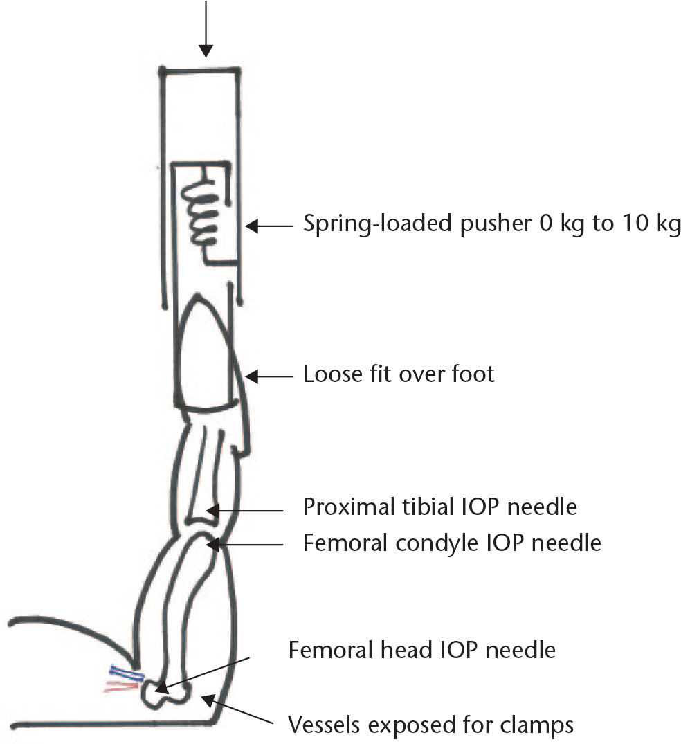 Fig. 1 
          Diagram showing experimental set up. The spring-loaded pusher covers the foot and prevents flexion and extension while applying a longitudinal one body weight load (4520 g to 5400 g; IOP, intraosseous pressure).
        