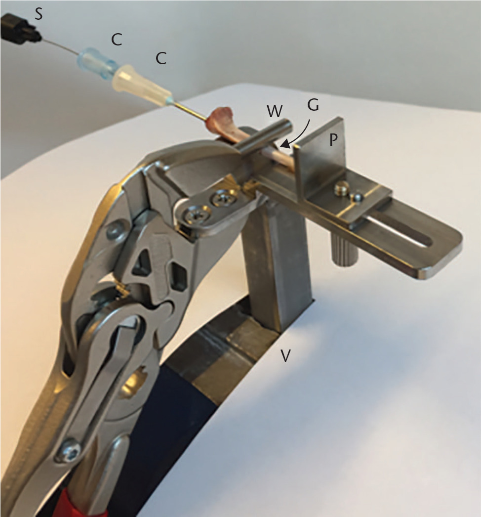 Fig. 1 
            Three-point loading fracture forceps secured in a vice (V). Photo from the pilot study using bone without soft tissue, showing the components of the nail: the stylus (S); and the two cannulas (C). In vivo, the heel was pressed against an adjustable plate (P) in order to obtain a standardized midshaft fracture as the wedge (W) pressed the leg into the groove (G) when the forceps was clamped.
          