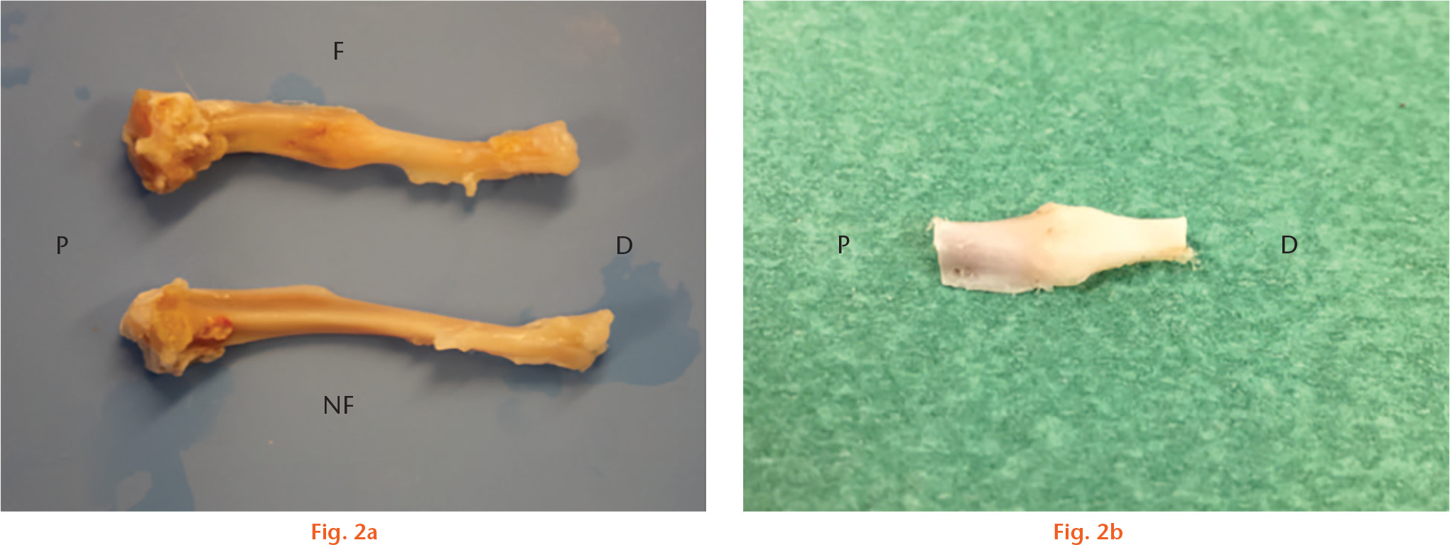 Fig. 2 
            Lateral-view photographs of tibia ex vivo at four weeks of healing. Orientation is proximal (P) to distal (D). a) Fractured (F) and non-fractured (NF) tibia from a specimen (‘parecoxib immediate’ (Pi) group) prepared for biomechanical tests. b) Segment of middle tibia containing callus in a specimen (control group) fixed for histological analysis.
          