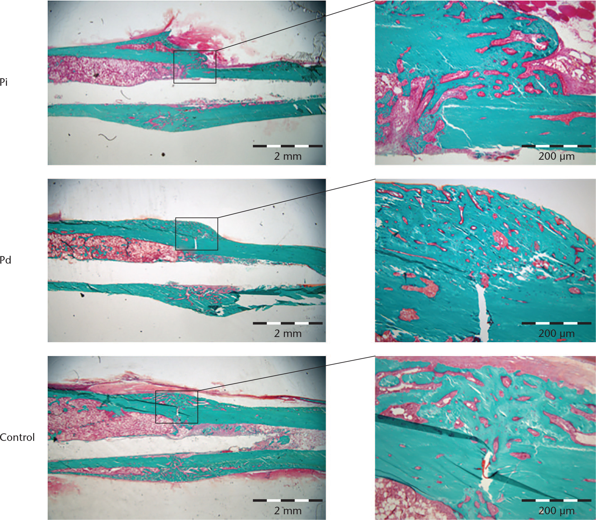 Fig. 6 
            Low-power (left panels) and high-power (right panels) magnification light microscopy of representative Masson–Goldner trichrome-stained sections of tibial fractures from the three study groups. Qualitatively, no differences between the study groups were observed. Scale bars = 2 mm (left panels) and 200 μm (right panels).
          