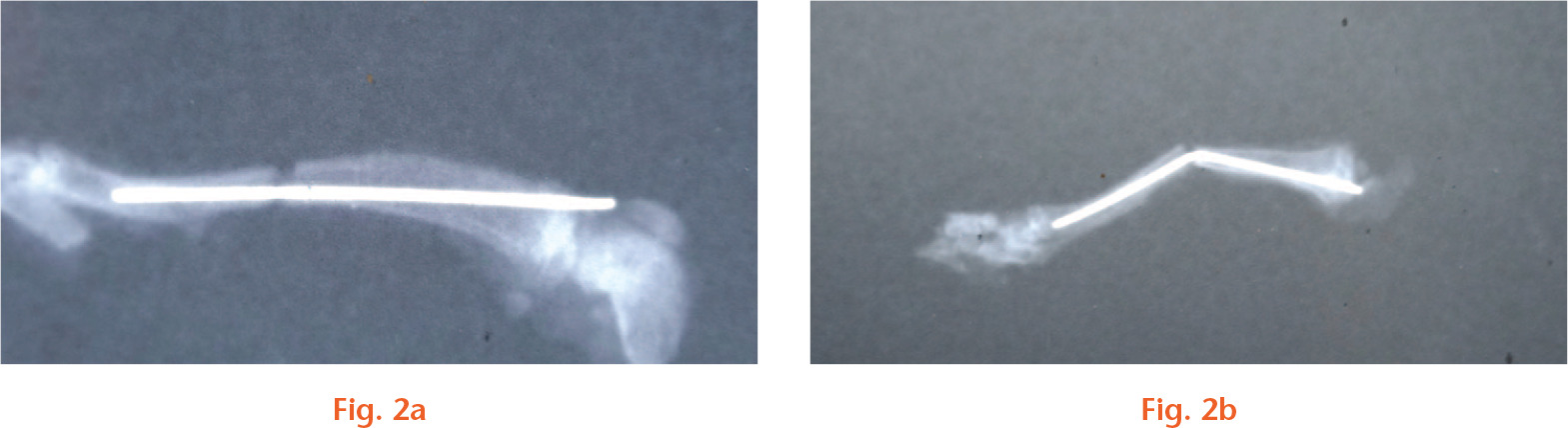 Fig. 2 
            Identification of mice models of femoral fracture by x-ray scanning. a) Radiograph of the right femur of normal mice; b) radiograph of the right femur of model mice.
          