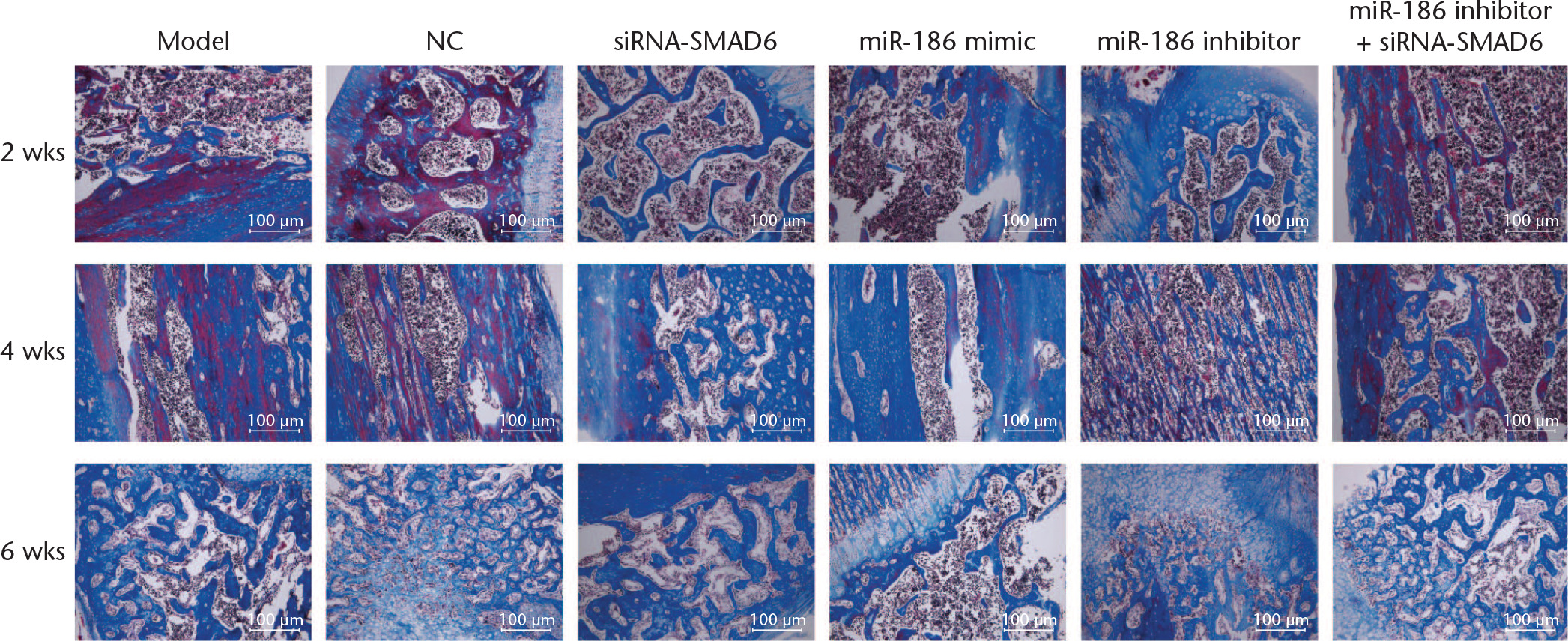Fig. 5 
            Masson’s trichrome staining (×100) demonstrates that overexpressed microRNA-186 (miR-186) and silencing SMAD family member 6 (SMAD6) promote callus formation. NC, negative control; siRNA, small interfering RNA; BMP, bone morphogenetic protein; β-actin, beta-actin.
          
