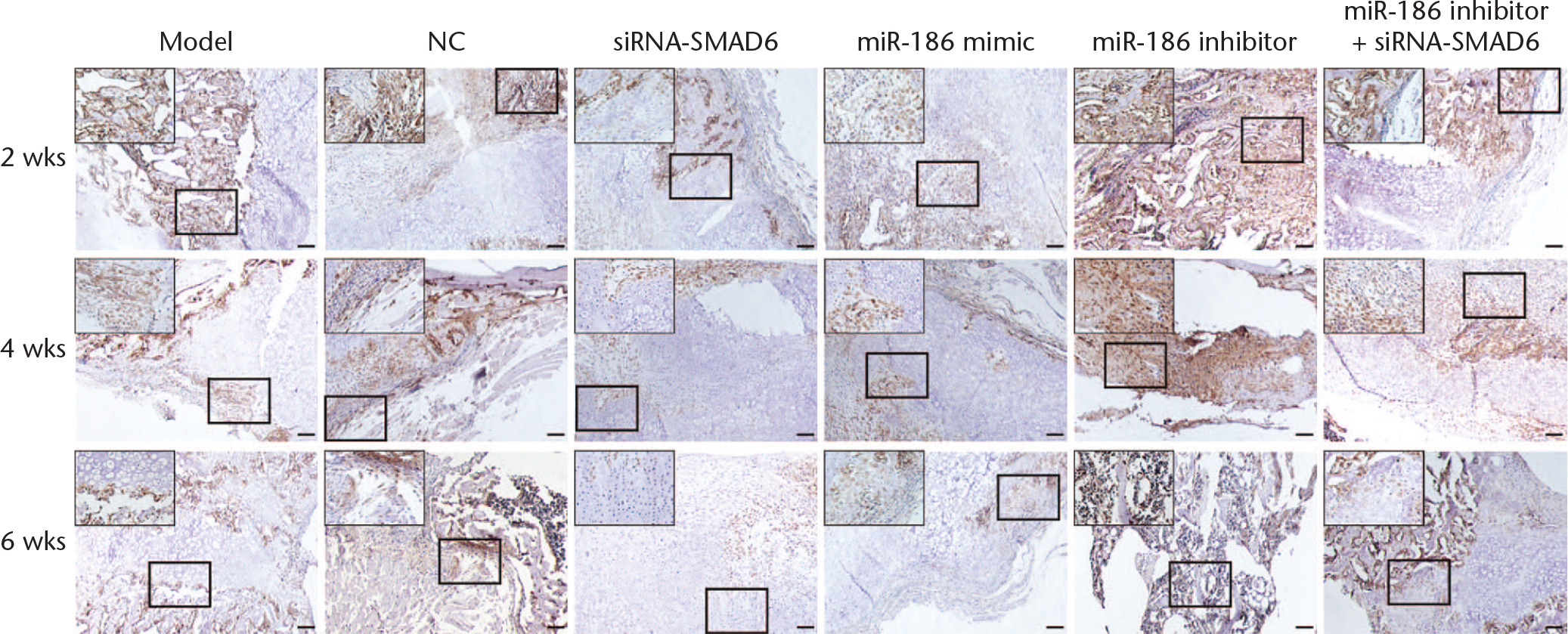 Fig. 7 
            Immunohistochemistry (×100) of callus tissue manifests that positive expression of SMAD family member 6 (SMAD6) is reduced by overexpressed microRNA-186b (miR-186) and silencing SMAD6. NC, negative control; siRNA, small interfering RNA.
          